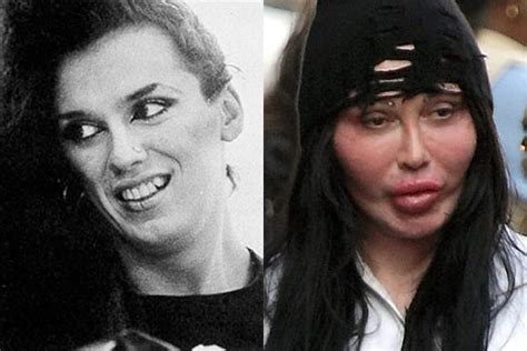 Cher plastic surgery rumours include having brow lift, face lifts, botox and fillers. 21 Celebrity Plastic Surgery Nightmares: Before & After ...