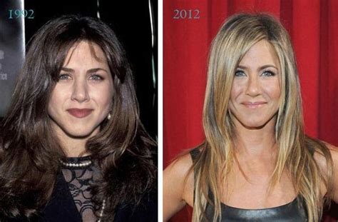 Jennifer Aniston Plastic Surgery For Puffy Looks