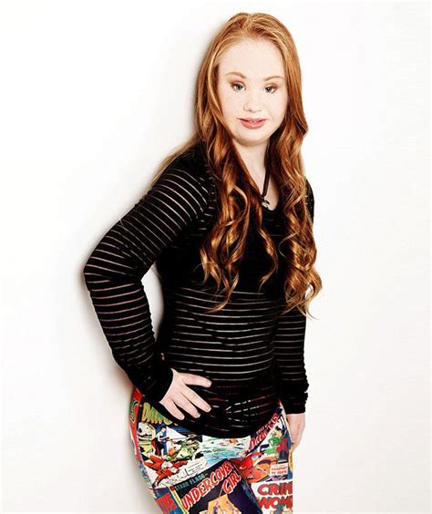 18 Year Old Teen With Down Syndrome Has A Serious Determination To Become A Model