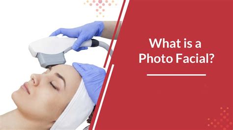What Is A Photofacial Healthy Anozo