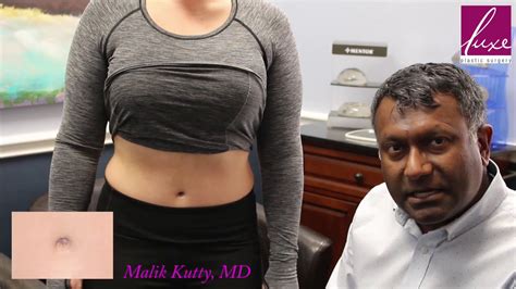Ingenious Idea For Healing A Tummy Tuck Bellybutton Youtube