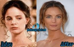 Gabrielle Anwar Plastic Surgery Before And After Pictures Plastic Surgery Facts