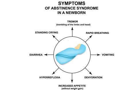 Neonatal Abstinence Syndrome Symptoms Causes And Treatment By Dr
