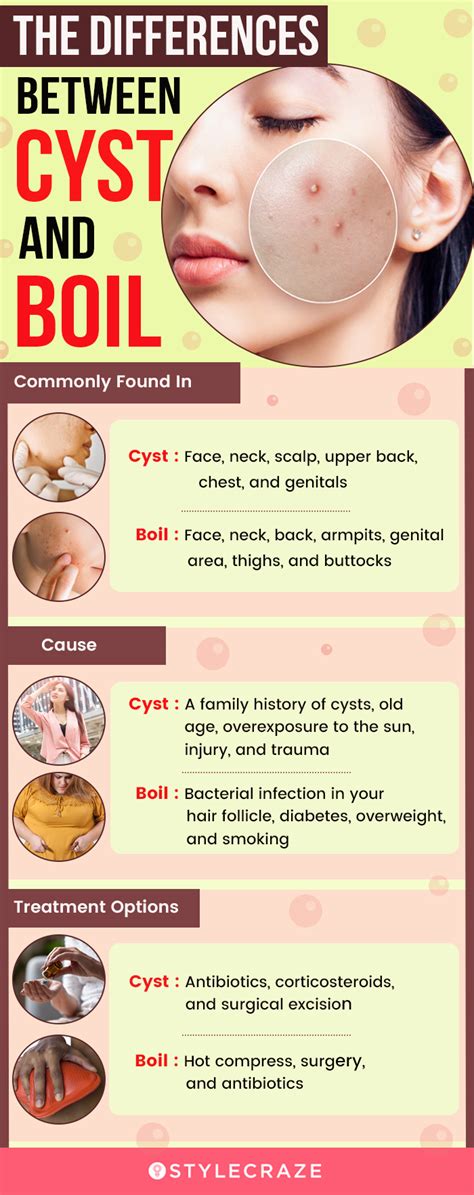 Cyst Vs Boil Difference Identification And When To See A Doctor