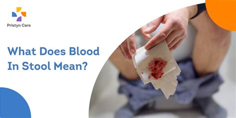 How To Check For Blood In Stool Memberfeeling16