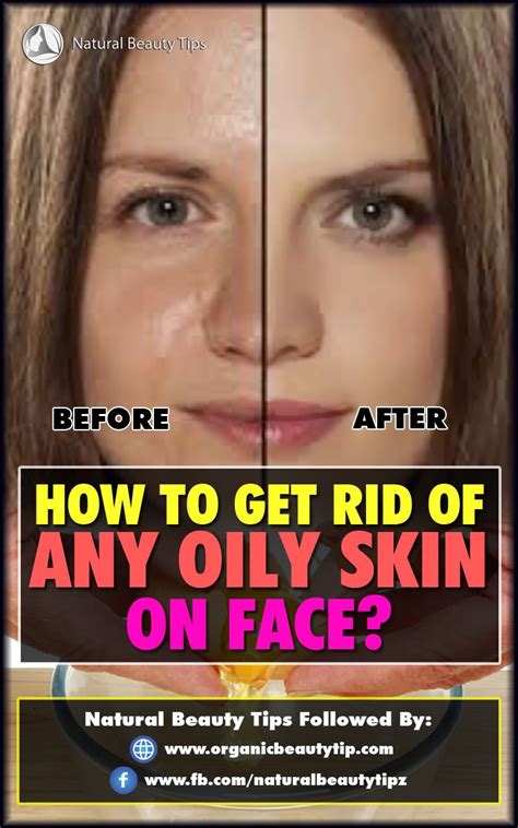 How To Get Rid Of Any Oily Skin On Face Oily Skin Natural Beauty