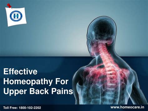 Ppt Upper Back Pain Causes Symptoms And Treatment In Homeopathy
