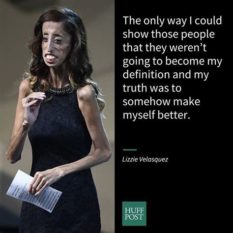 How Being Called The Worlds Ugliest Woman Transformed Her Life