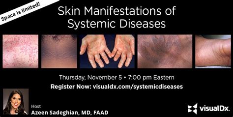 Skin Manifestations Of Systemic Disease Visualdx