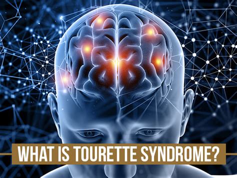 World Disability Day Tourette Syndrome Causes Symptoms Diagnosis And Treatment Boldsky Com