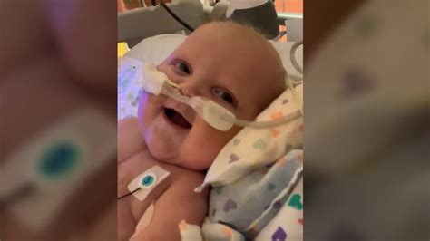 Baby Born With Half A Heart Smiles For The Very First Time After 2nd