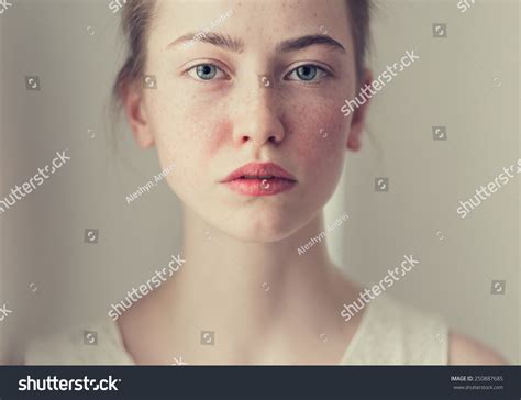 Face Beautiful Girl Freckles Closeup Stock Photo 250887685 Shutterstock