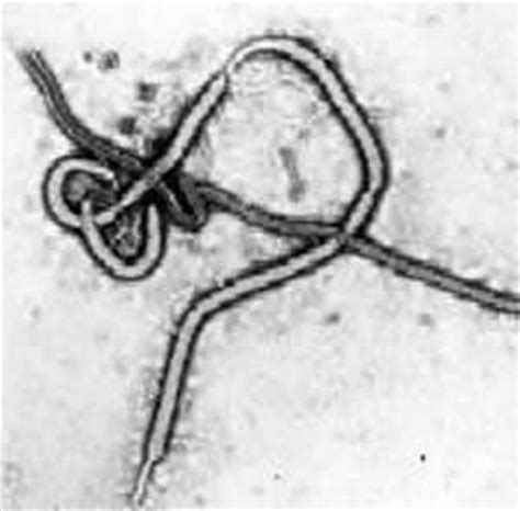 Posted 06 jan 2021 in pc games, request accepted. Ebola virus