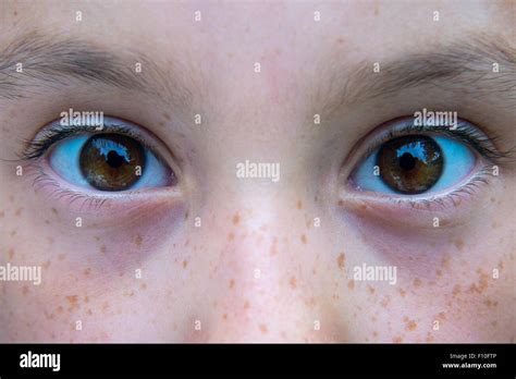 Close Up Of Child Girls Brown Eyes Freckles Freckle Stock Photo Alamy