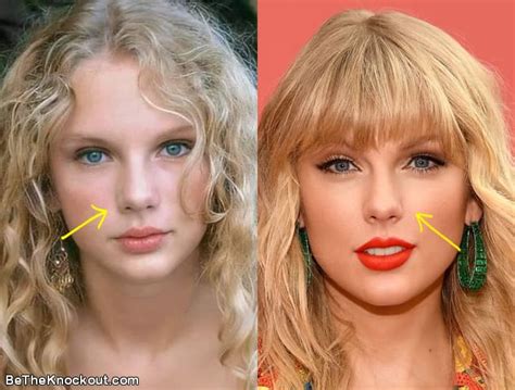 Taylor Swift Plastic Surgery Comparison Photos