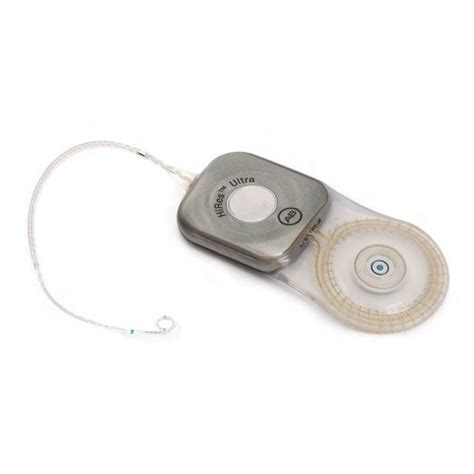 Internal Component Cochlear Implant HiRes Ultra Advanced Bionics