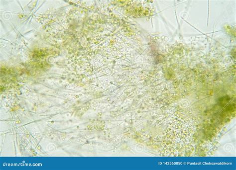 Filamentous Algae Are Single Algae Cells That Form Long Visible Chains