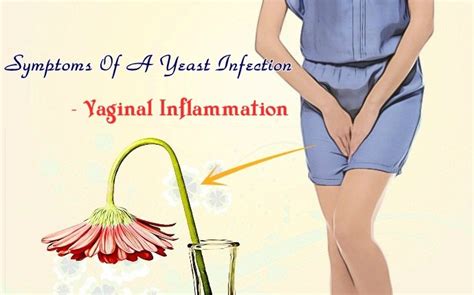 Top Common Symptoms Of A Yeast Infection That You Should Know