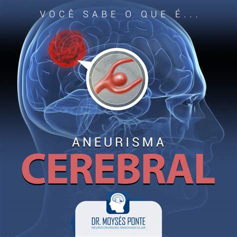 O Que Aneurisma Cerebral Dr Moys S Ponte
