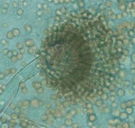 Aspergillus flavus is a saprotrophic and pathogenic fungus with a cosmopolitan distribution. SGS Forensic Laboratories
