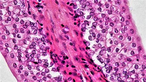Epithelial Tissues Transitional Cross Section Urinary Bl Flickr