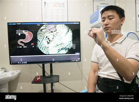 A New Capsule Gastroscope Robot Was Shown In A 5g Smart Clinc In
