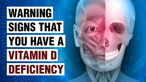 Signs And Symptoms Of Vitamin D Deficiency Healthy Living Free