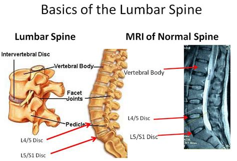 An upper lip and a lower lip. MYO Therapy & Healthcare Institute: Herniated Disk