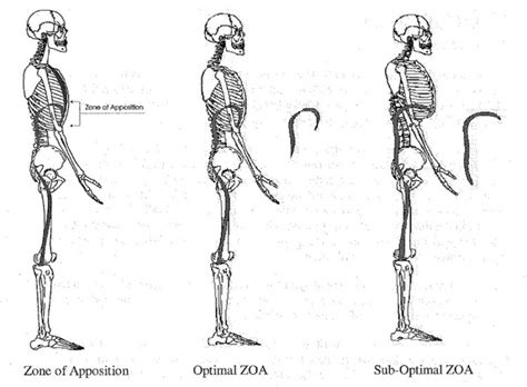 Hip Impingement | EDGE Physical Therapy in Omaha, Papillion, NE