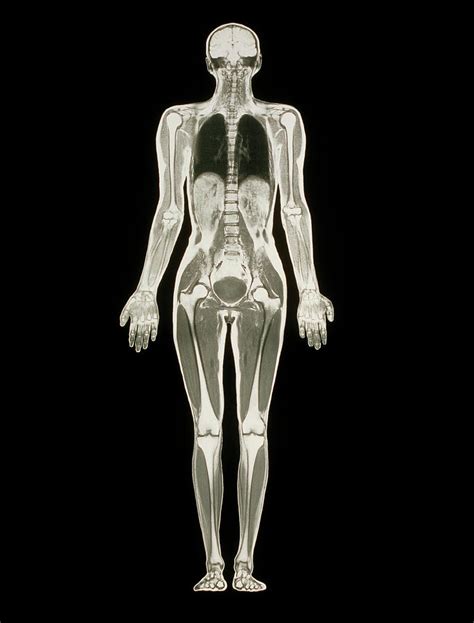 Mri Scan Of A Whole Human Body Female Photograph By Simon Fraser Science Photo Library