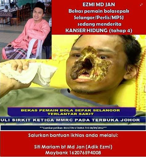 Servik kanseri( serviks kanseri) merkezi servikal kanser slayt gösterisi resimleri 15 kanser. Bekas Pemain Bola Sepak Selangor Terlantar Sakit | Blog Buruk