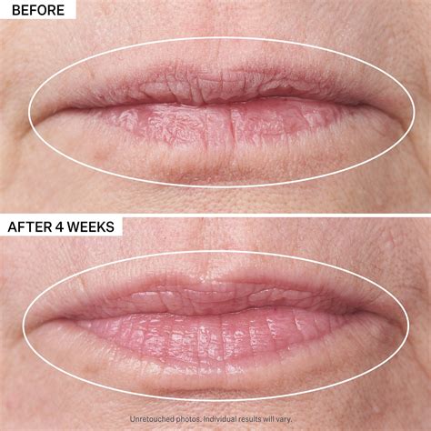 Strivectin Double Fix ™ For Lips Plumping And Vertical Line Treatment