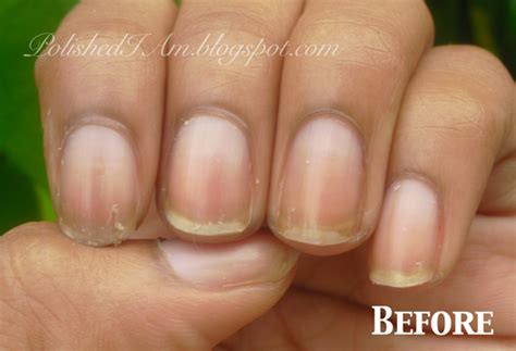 Peeling Nails Marie Claires Pure Nail Oil™ Results Nail Care Hq