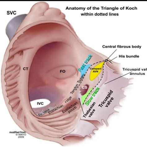 Pin By Kimberly Volkman On Lovecho Diagnostic Medical Sonography