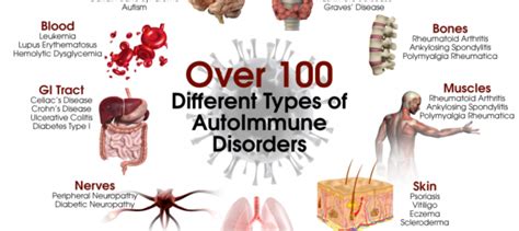 Autoimmune Disease Creative Biolabs Blog