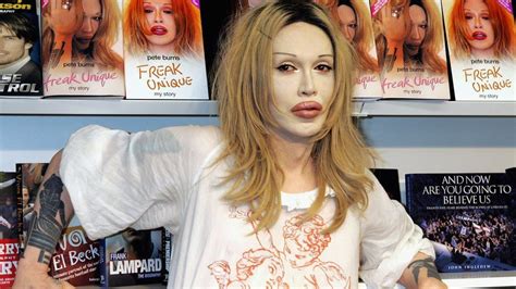 Pete Burns Dead Or Alive Singers Career In Pictures Bbc News