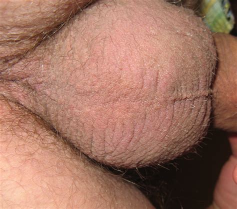 Img0504a In Gallery More Of My Cock W Precum