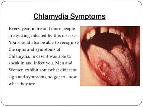 What Is Chlamydia Disease