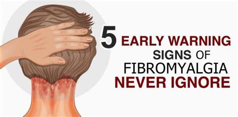Fibromyalgia And Hair Loss Treatment Resolve Abouthairloss