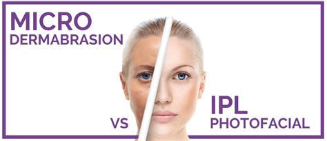 Microdermabrasion Vs Ipl Photofacial Whats The