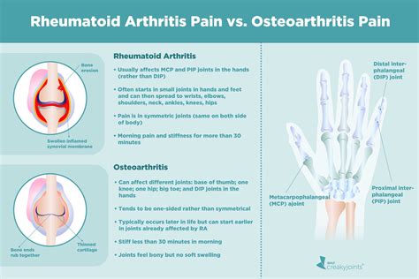 Rheumatoid Arthritis Vs Osteoarthritis What’s The Difference
