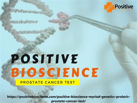 Ppt Prostate Cancer Test For Cancer Diagnosis Prolaris Testing Kit