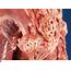 Tumors Of Muscle  Veterian Key