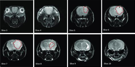 Mri Imaging Of Gbm Tumor In Pdox Brain Mri Slices Of Mouse Head From