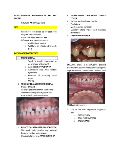 Oral Pathology Prelims Developmental Disturbances Of The Tooth