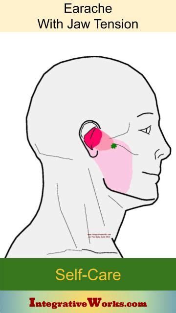 Trigger Points Earache And Jaw Tension Integrative Works Jaw Pain