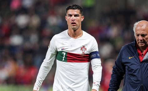 Cristiano Ronaldo Sale Mal Herido En Duelo De Nations League