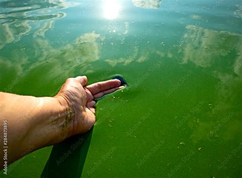 Human Hand Polluted With Blue Green Algae Water Pollution By Blooming