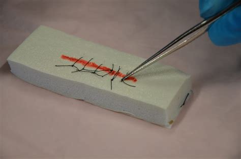 4 7 Suture Removal Clinical Procedures For Safer Patient Care