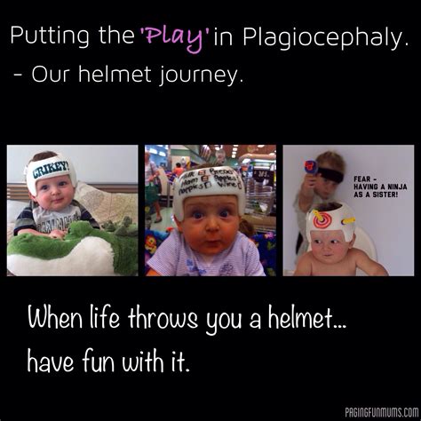 Putting The Play In Plagiocephaly Pla Gi O Ceph A Ly Paging Fun Mums